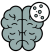 tumor-cerebral-cdmx